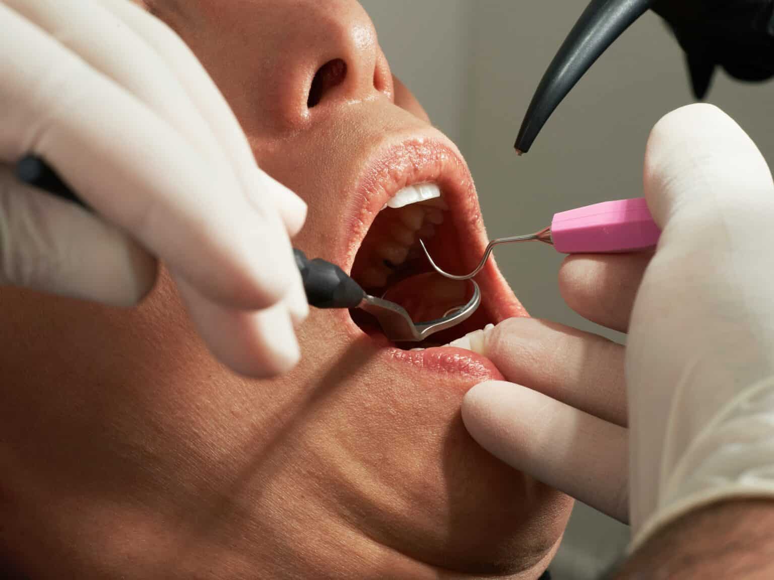 Consulter un dentiste : tout ce qu’il faut savoir ! dentiste