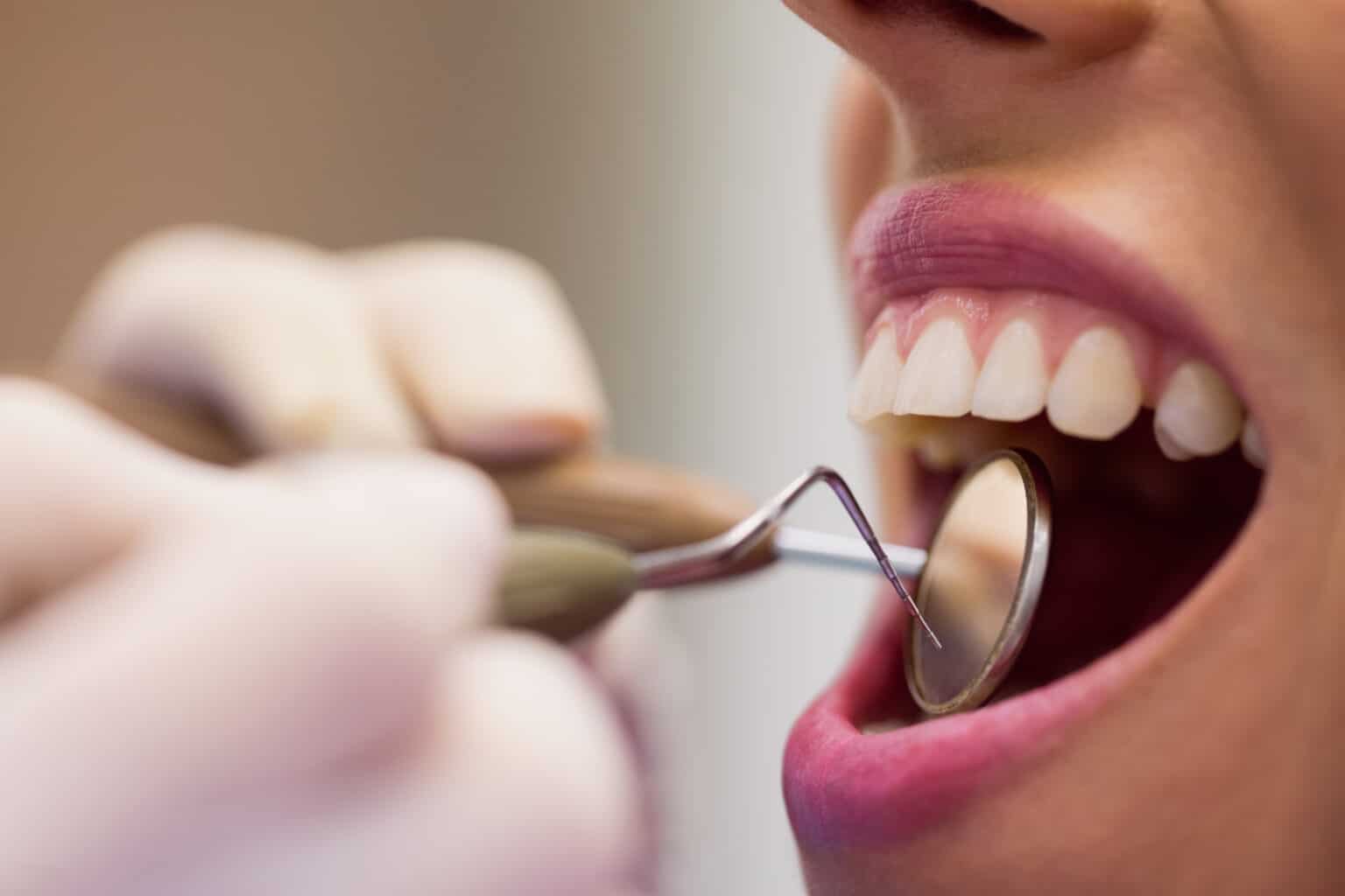 Près de 400 victimes, des dizaines de mutilations dentaires injustifiées… La justice s’apprête à trancher l’affaire de ce scandale médical en Provence-Alpes-Côte d’Azur dentiste